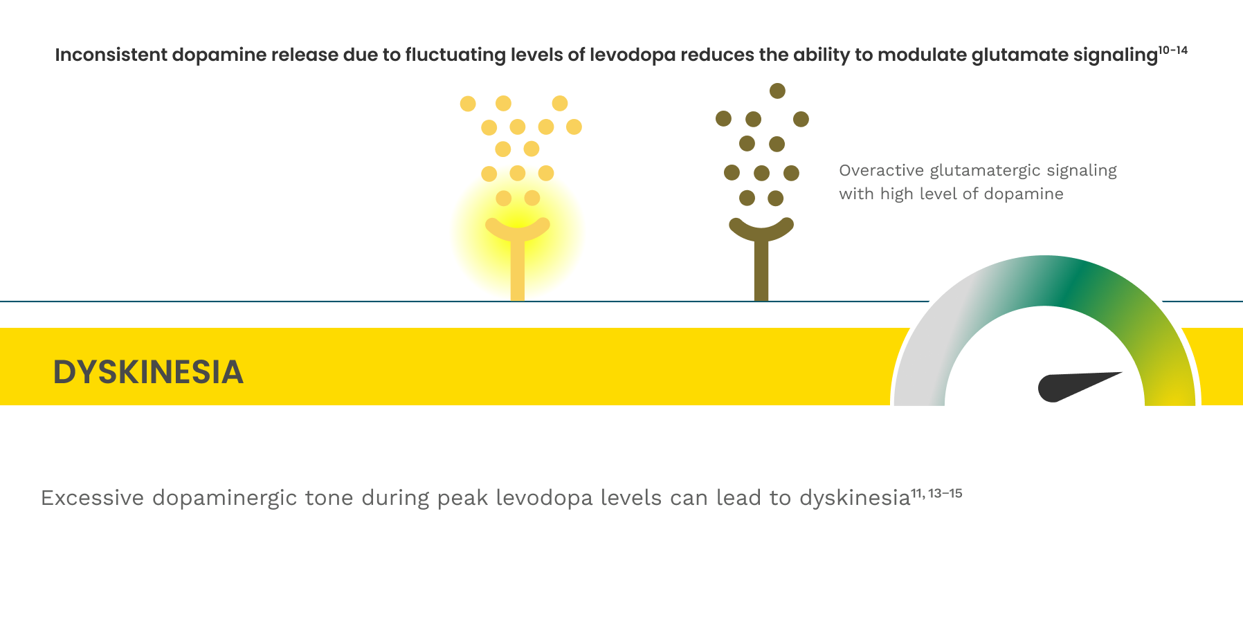 Illustration of dopamine and NMDA receptors during dyskinesia.