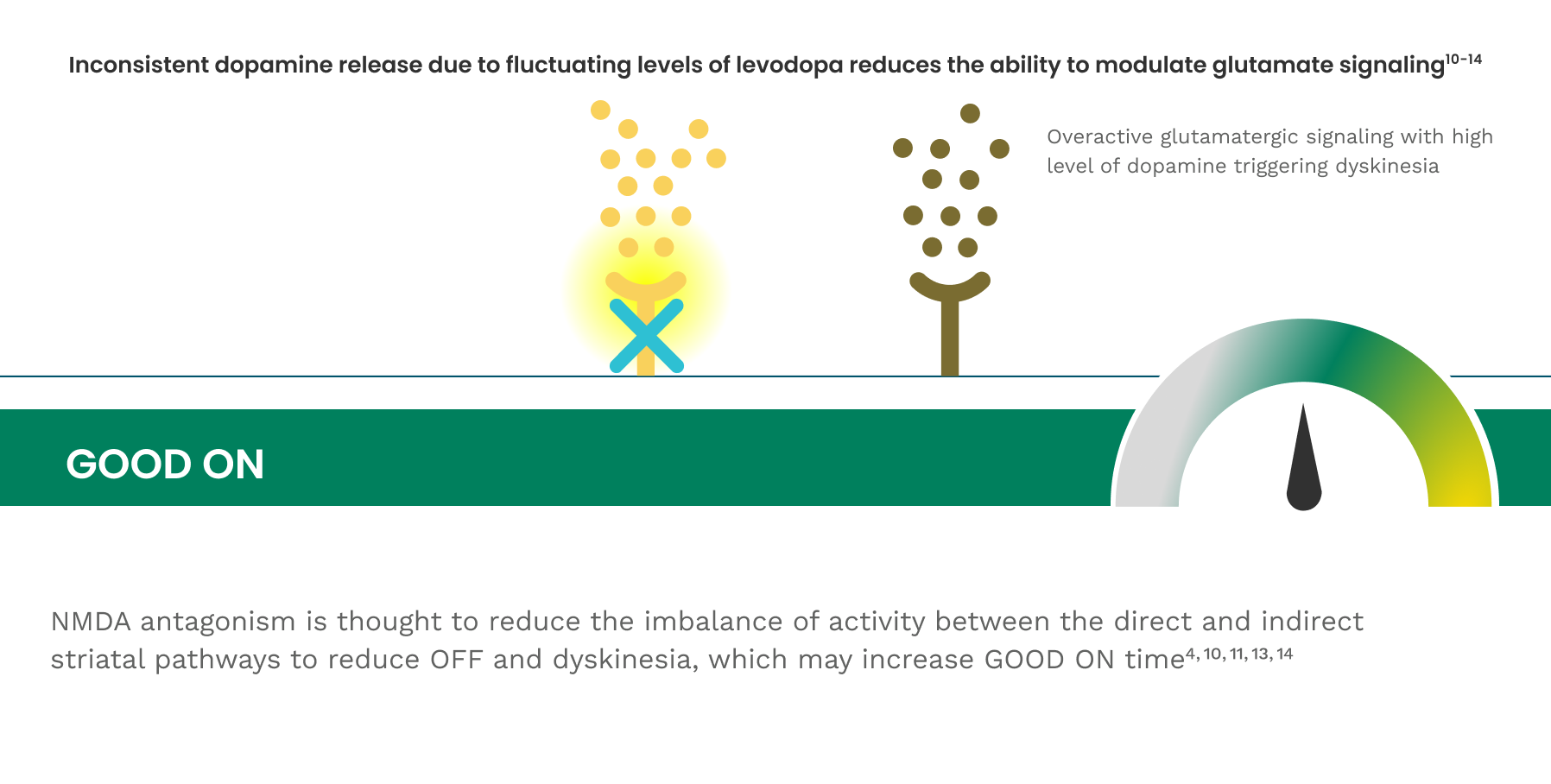 Illustration of NMDA antagonism and excessive dopaminergic tone during GOOD ON time.